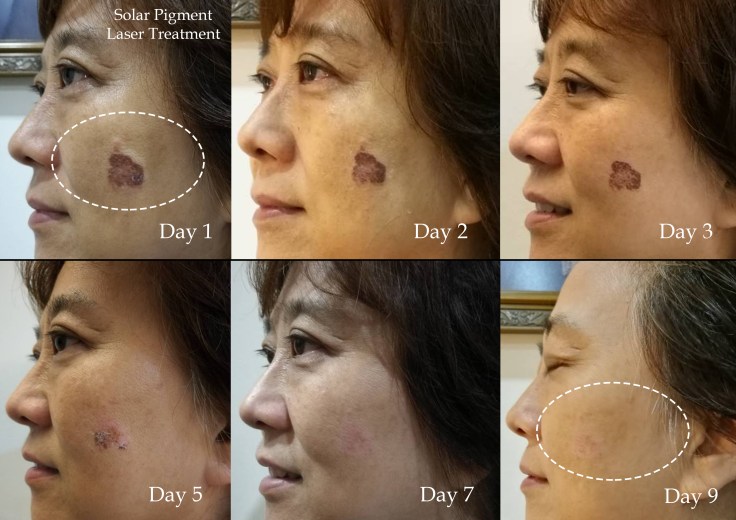 susan ruvy daily progress