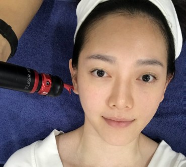 my decision for lutronic laser