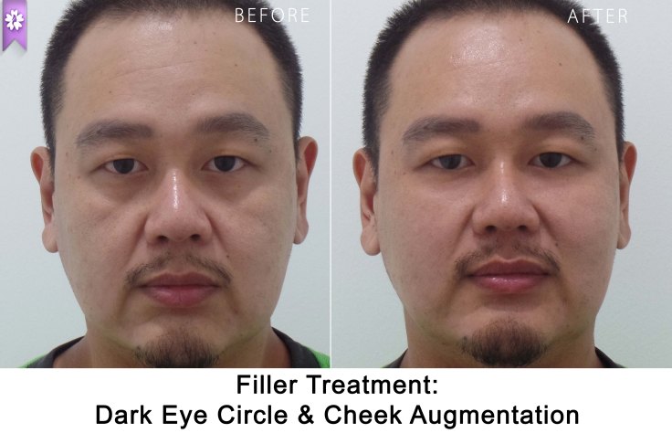 SAMSUNG CAMERA PICTURES