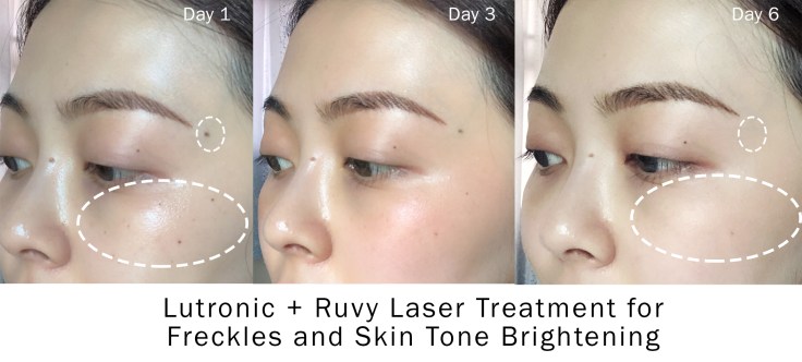 daily progress resize